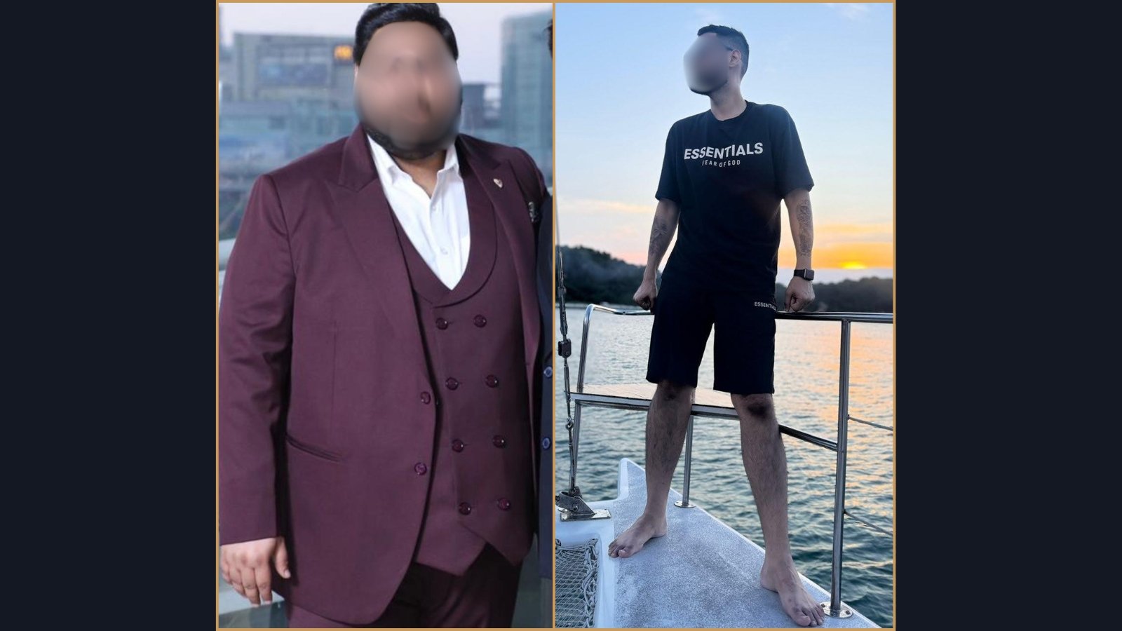 Patient transformation following bariatric surgery